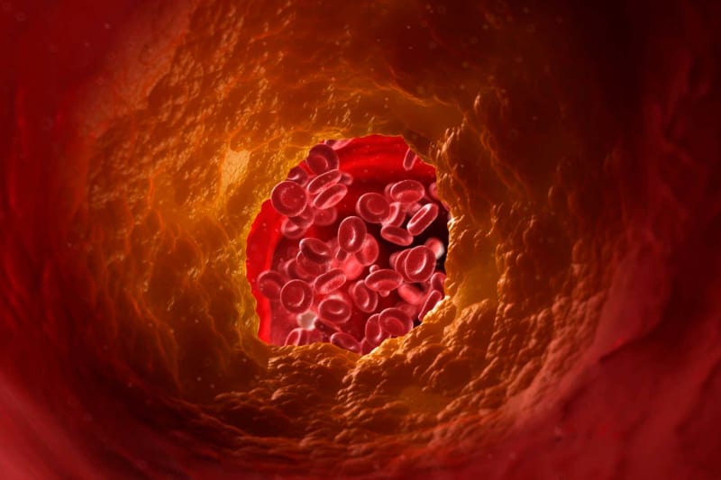 Cancer-Fighting Cells May Slow ALS, Other Brain Diseases - Image 5