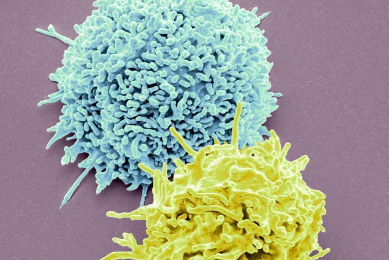 1 in 10 People Carry Genes That Make Them Vulnerable to EBV - Image 3
