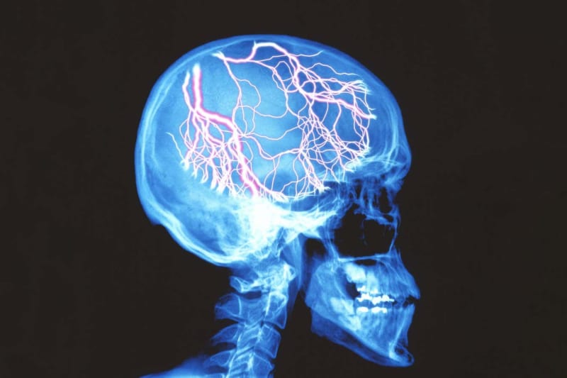 New Migraine Drug Targets Could Help 400 Million People - Image 3