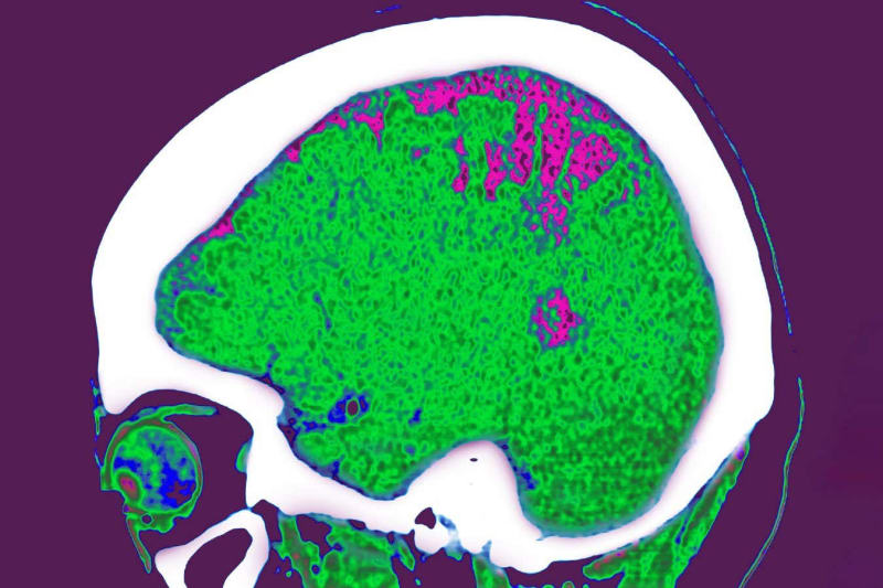 Body Fat Helps Control Blood Pressure, New Studies Find - Image 4
