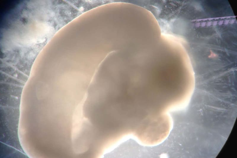 Scientists Grow Mini-Brain With Working Blood Vessels - Image 5