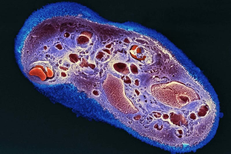 Placenta Dressings Cut Scarring in New Wound Study