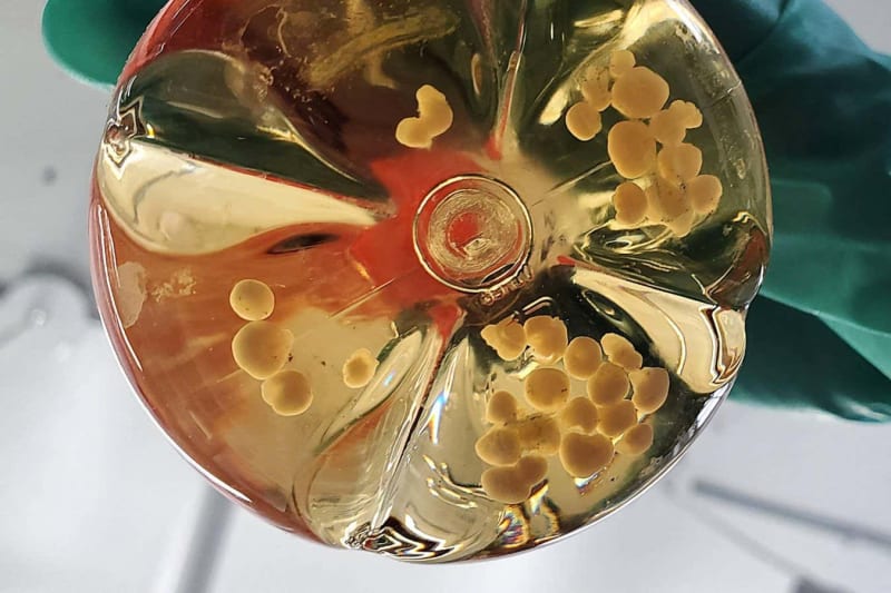 Scientists Grow Mini-Brain With Working Blood Vessels