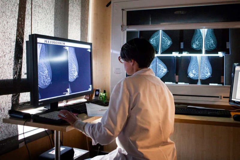 Radiologist reviewing mammogram images on computer screen with AI assistance software interface