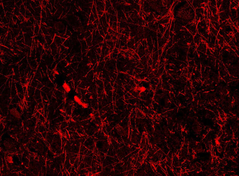 Microscope image showing newly discovered tube-like structures wrapped around brain blood vessels in human tissue