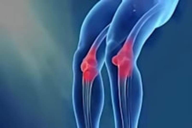 Lost Renaissance Masterpiece Found in North Carolina Home - Image 3