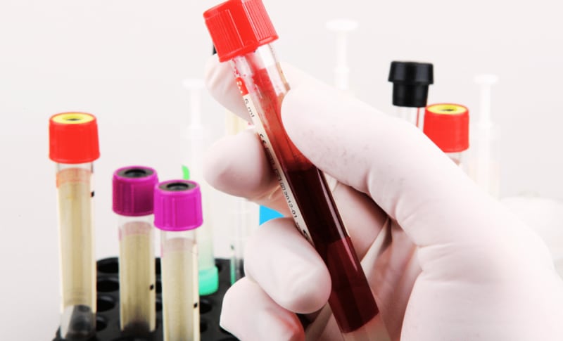 Scientists Solve 52-Year Blood Mystery, Help Rare Patients