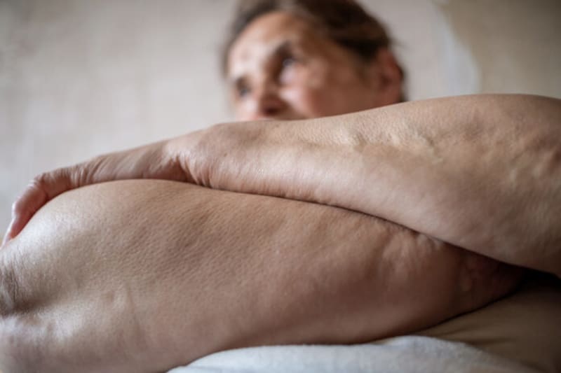 Auckland Scientists Find New Way to Treat Lymphoedema - Image 2