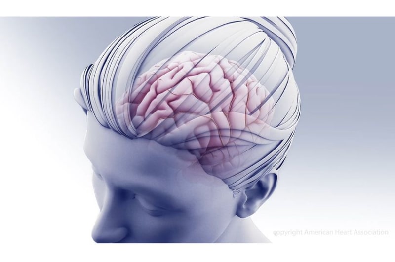 Smartwatch Detects Social Life in Stroke Survivors