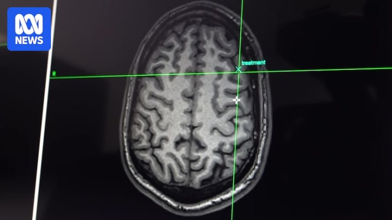 Sunshine Coast Clinic Uses Brain Scans to Treat Depression