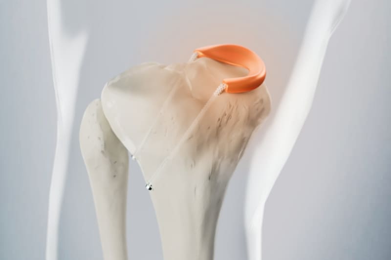 FDA Fast-Tracks Knee Implant That Could Replace Surgery