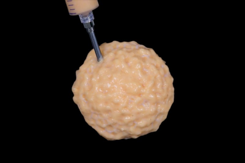 Engineer 3D Prints Hope for Breast Cancer Survivors - Image 3