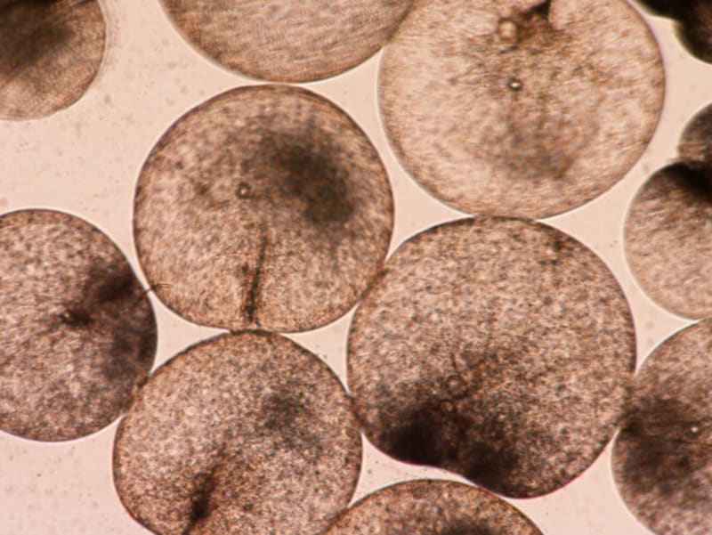 AI Reveals Ocean Algae Blooms Growing Worldwide Since 2010 - Image 4