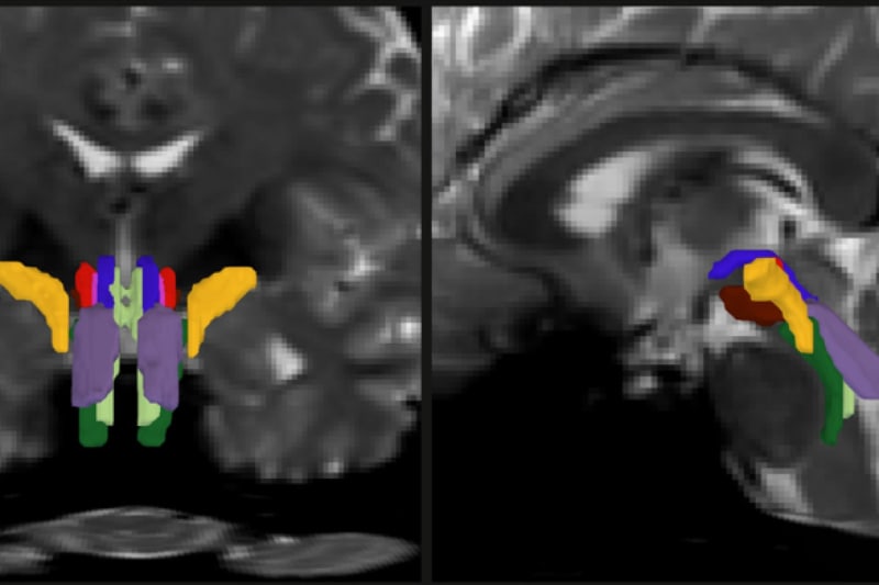 Color-coded cross-section of human brainstem showing eight distinct nerve fiber bundles segmented by AI