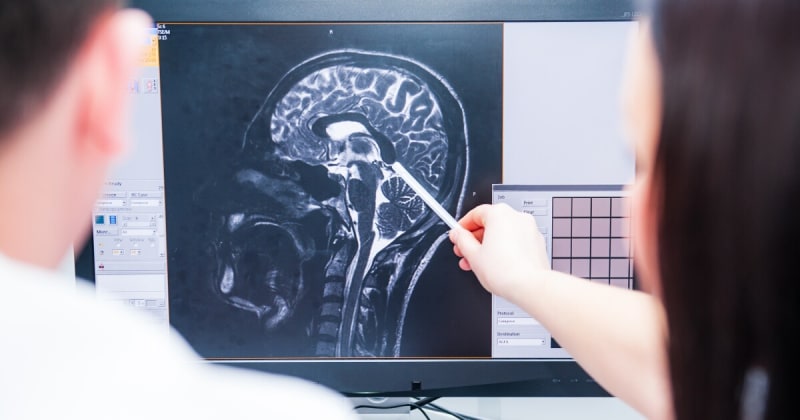 UVA Scientists Discover Promising Way to Protect Brain Health After Head Injuries