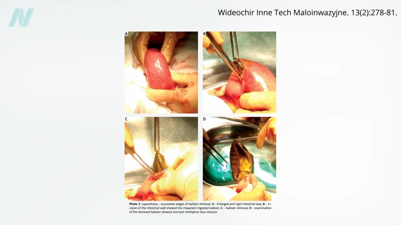 Sham Surgery Studies Prove Medical Science Can Self-Correct - Image 2