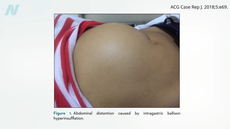 Sham Surgery Studies Prove Medical Science Can Self-Correct - Image 3