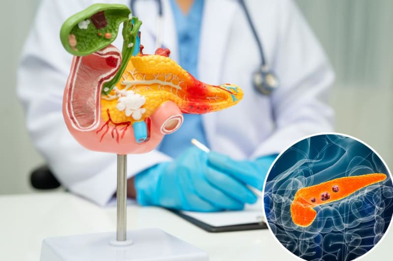 Spanish Researchers Eliminate Pancreatic Tumors in Mice - Image 2