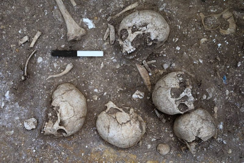 Cambridge Dig Uncovers 9th Century Brain Surgery Evidence - Image 4