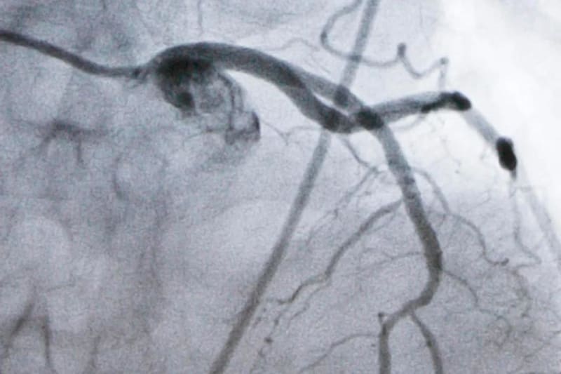 New Cholesterol Pill Slashes Bad Cholesterol by 60% - Image 2