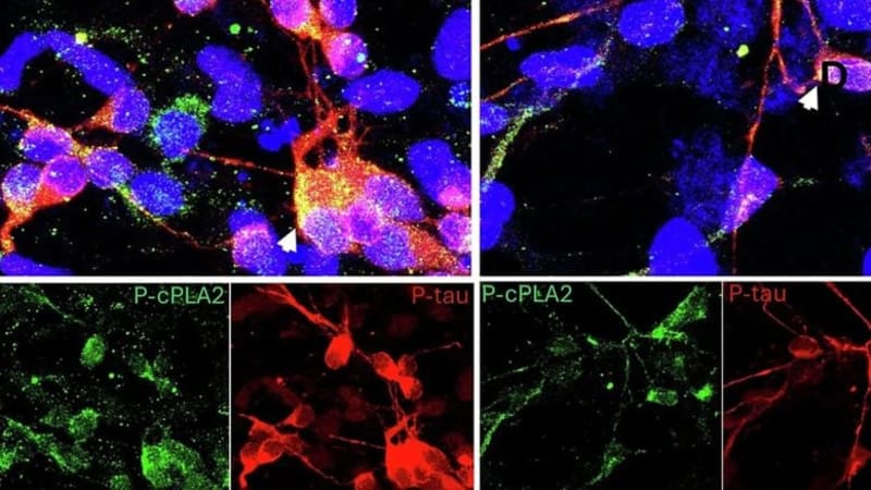 USC Scientists Find Brain Drug to Fight Alzheimer's - Image 3