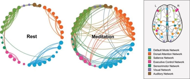 7-Day Meditation Retreat Rewires Brain and Blood, Study Finds - Image 4