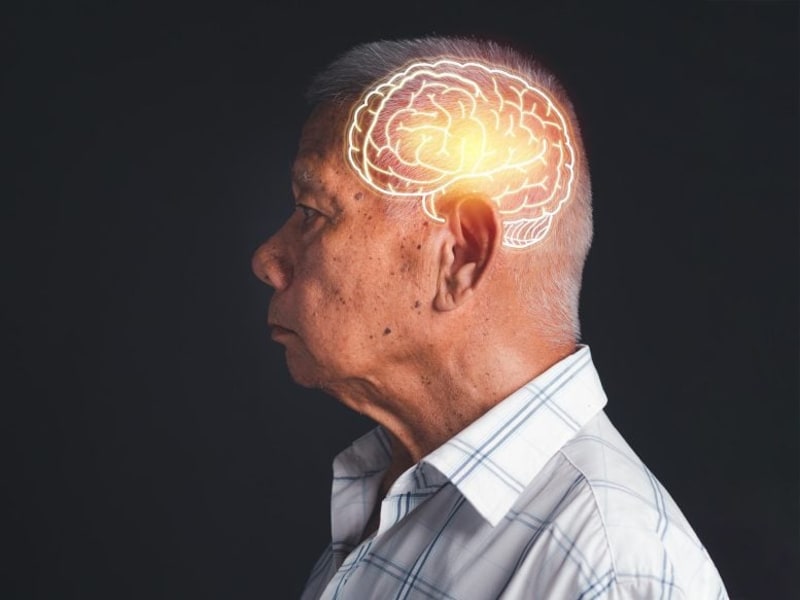 USC Scientists Find Brain Drug to Fight Alzheimer's - Image 2