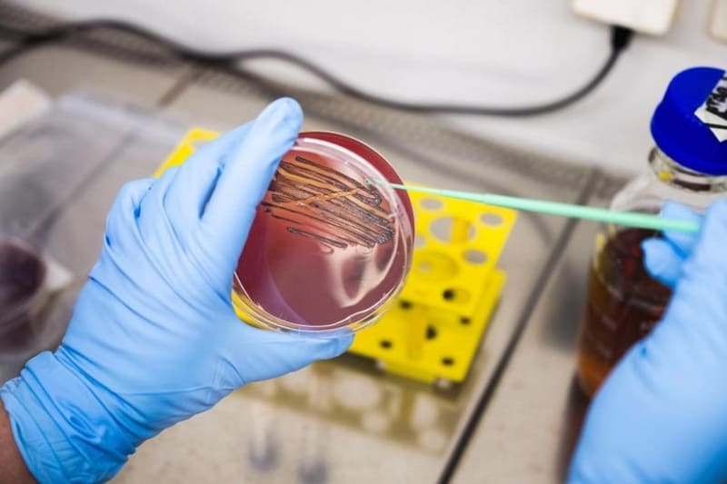 New Toothpaste Targets Gum Disease, Spares Good Bacteria - Image 3