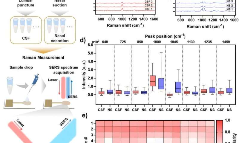 AI Diagnoses Brain Fluid Leaks in Under One Minute - Image 3