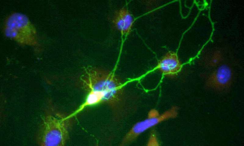 Scientists Crack Code of Chronic Pain Neurons - Image 3