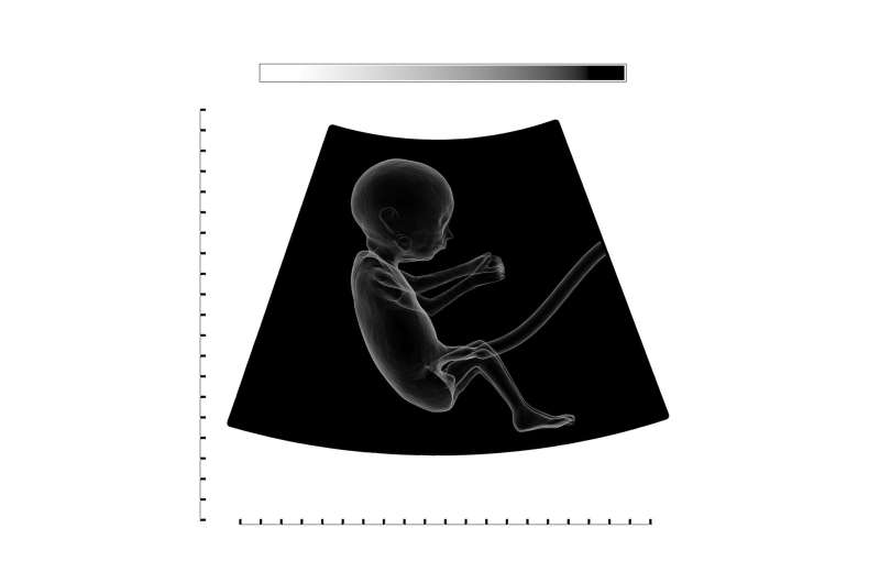 AI Detects Dangerous Pregnancy Condition Doctors Often Miss - Image 3