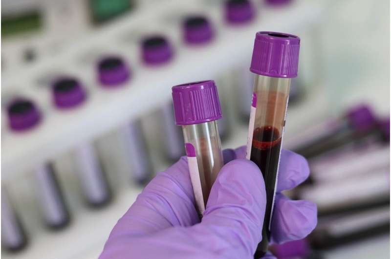 New Blood Test Detects 88% of Early Pancreatic Cancers - Image 3