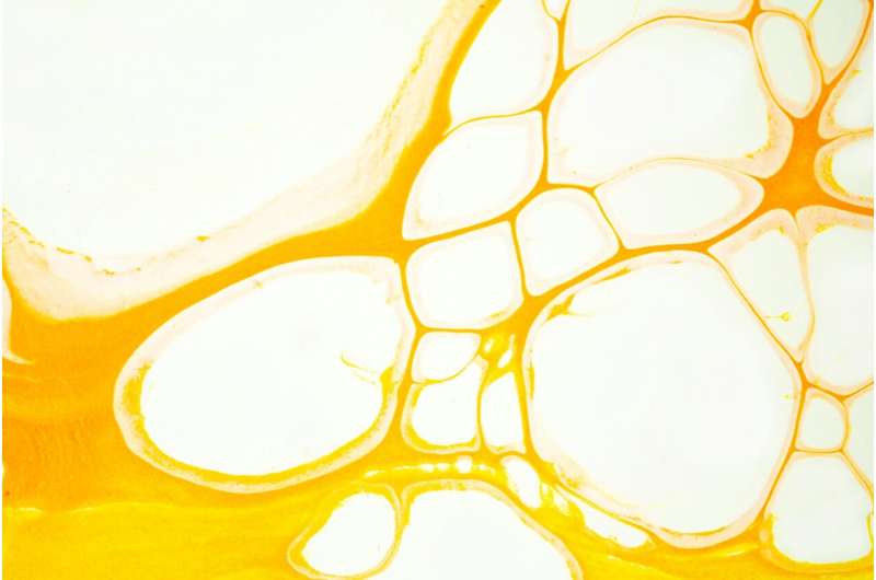 Scientists Turn Cancer's Spreading Trick Into a Cure - Image 3
