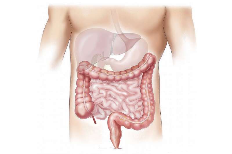 Young People Are Catching Colon Cancer Early—And That's Saving Lives - Image 3