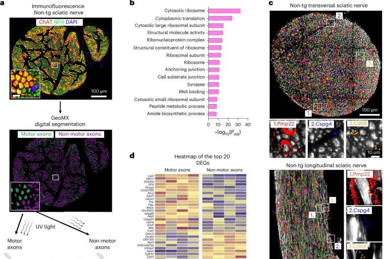 Belgian Scientists Find New Hope for ALS Treatment - Image 3