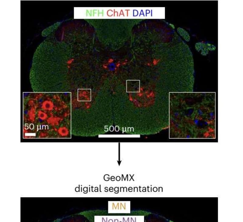 Belgian Scientists Find New Hope for ALS Treatment - Image 4