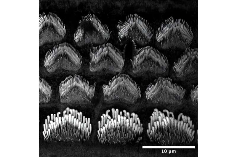 Scientists Find New Way to Prevent Permanent Hearing Loss - Image 2