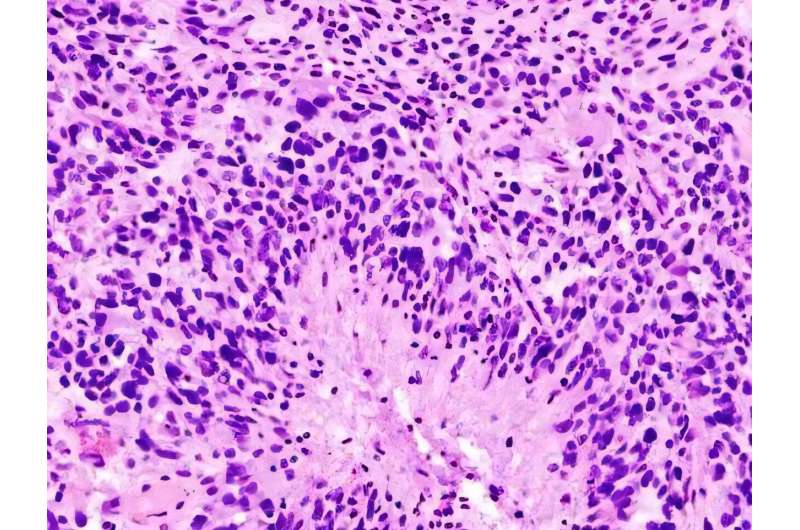 Modified Virus Helps Immune System Fight Deadly Brain Cancer - Image 2