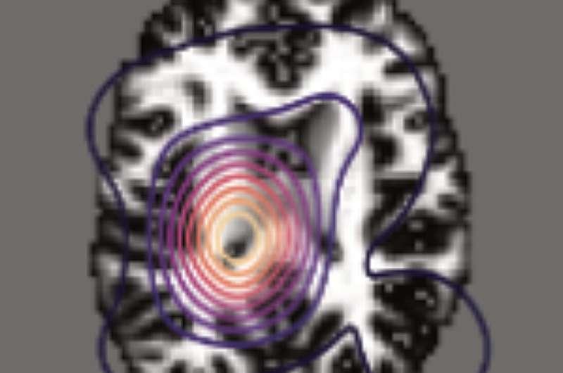 New AI Predicts Brain Disorders From Standard MRI Scans - Image 3
