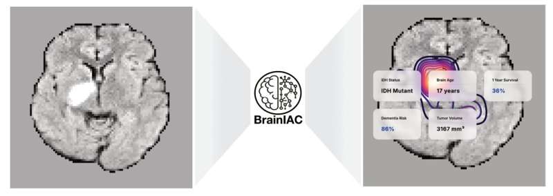 AI Tool Predicts Brain Age and Cancer Survival from MRIs - Image 3
