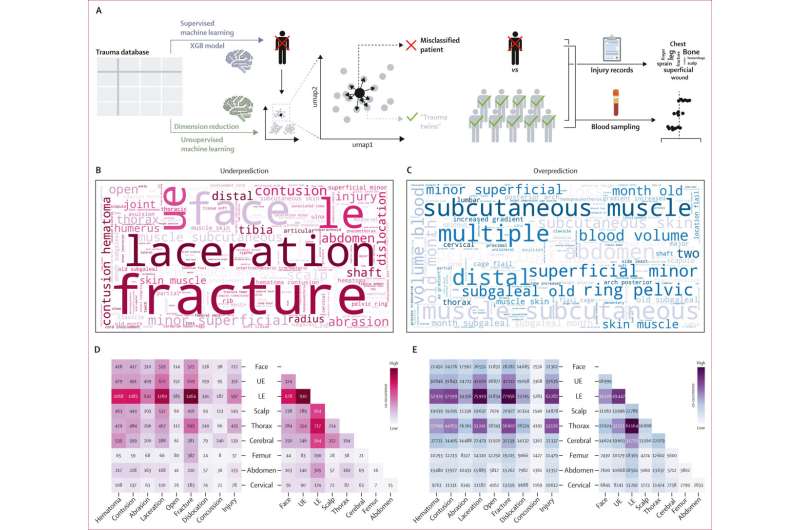 AI Predicts Trauma Bleeding Before Hospital Arrival - Image 3