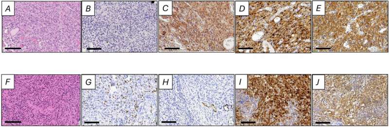 Oral Drug Shows Promise Against Deadly Brain Tumors - Image 3
