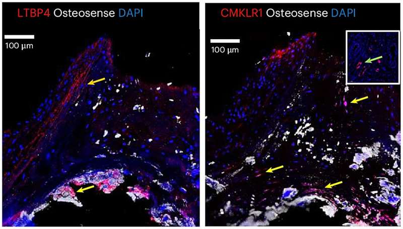 Scientists Find 200 Genes Linked to Heart Valve Disease - Image 2