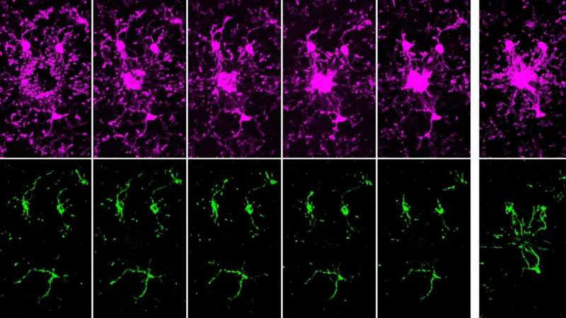Brain Immune Cells Use Sugar, Then Build Roads for Backup - Image 2