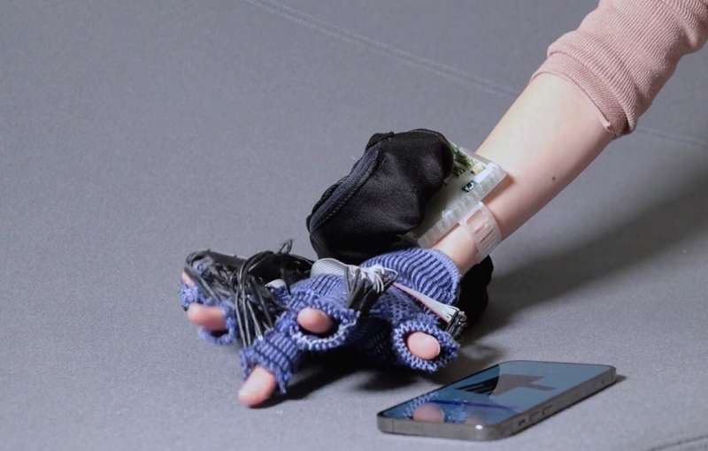 Smart Glove Cuts Hand Swelling by 25% at Home - Image 3