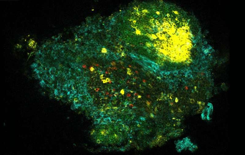 Why Farm Kids Get Fewer Allergies: Yale Solves the Mystery - Image 3