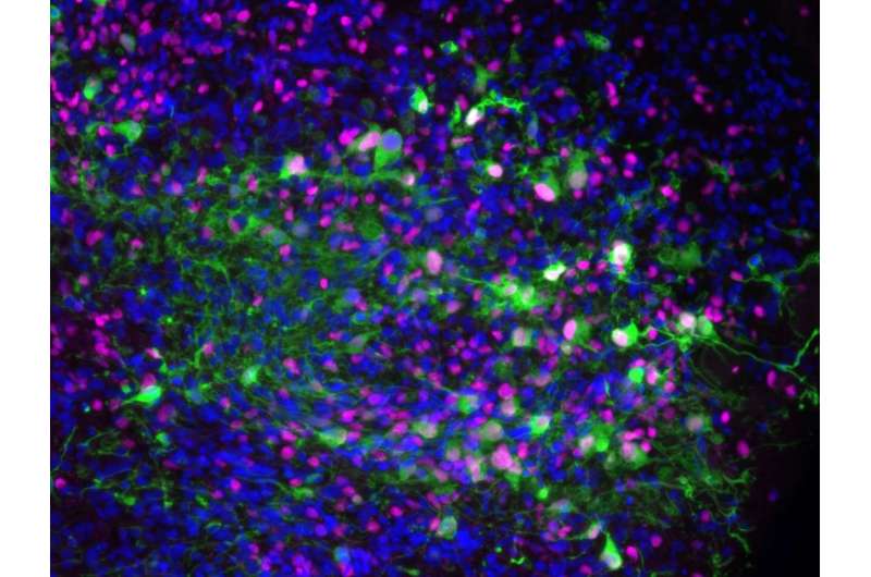 UCLA Creates Lab-Grown Brains to Outsmart Glioblastoma - Image 3