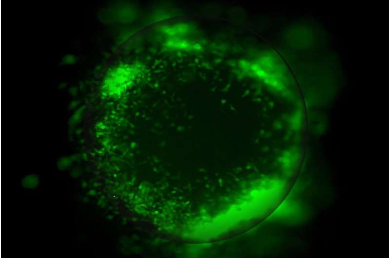 UCLA Creates Lab-Grown Brains to Outsmart Glioblastoma - Image 2