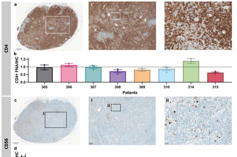 Simple Needle Test May Spare Breast Cancer Patients Surgery - Image 3