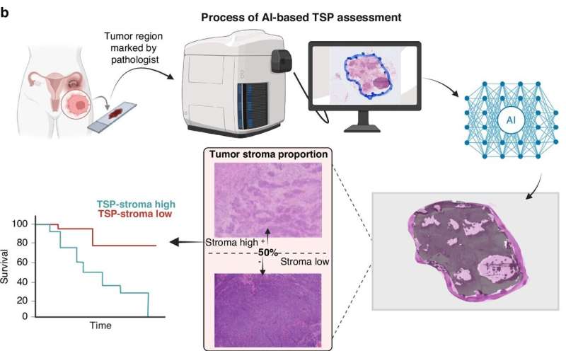 AI Tool Predicts Best Ovarian Cancer Treatment at Diagnosis - Image 4